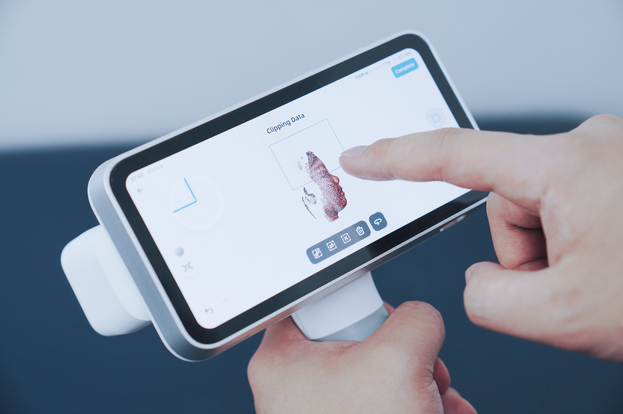 A clinician uses the EinScan Medixa touchscreen to crop and edit a 3D facial scan directly on the device.