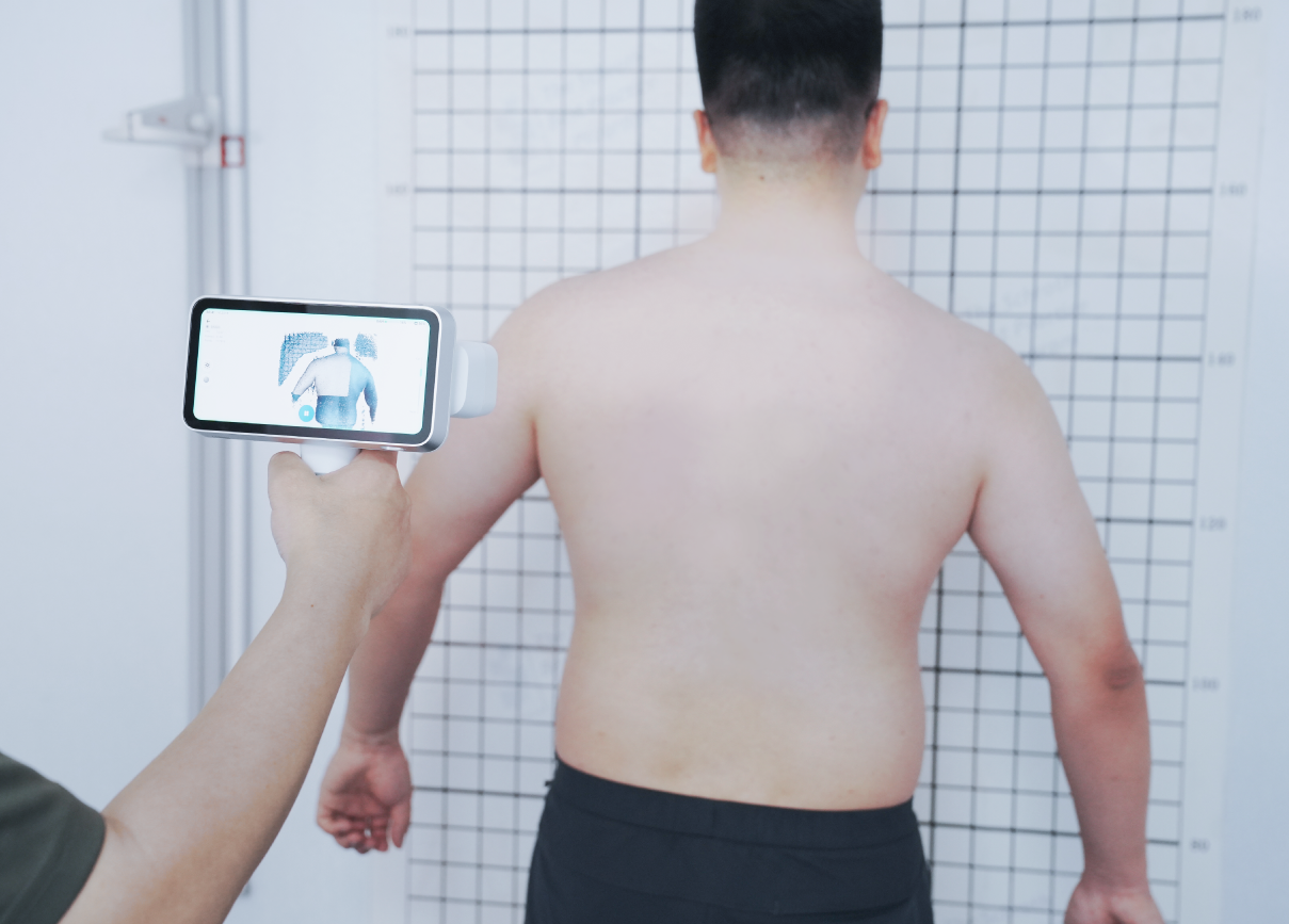 A clinician scans a patient’s back using the EinScan Medixa, with the device screen showing a live 3D preview.